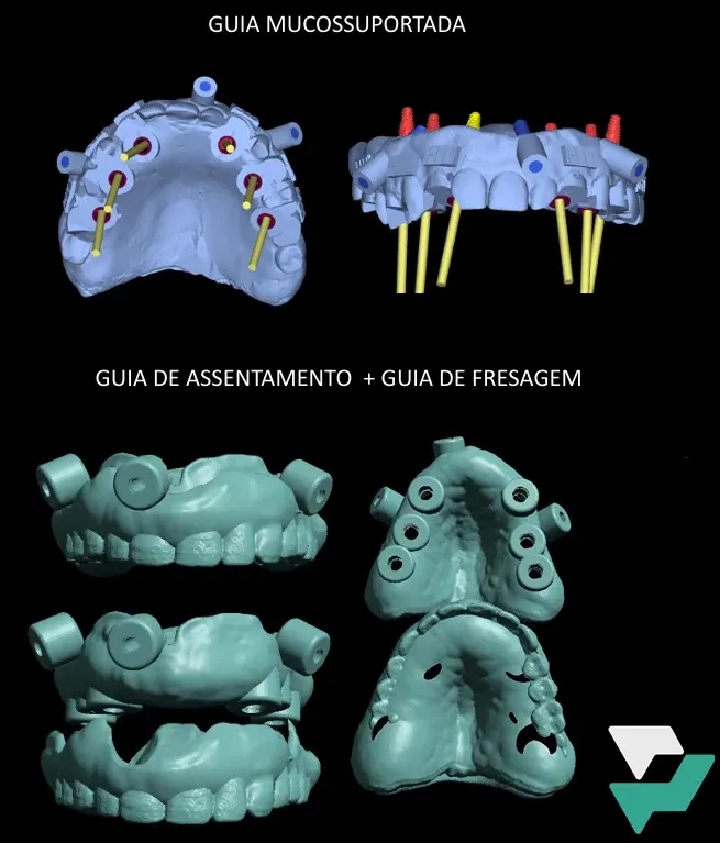 Guias Mucossuportadas