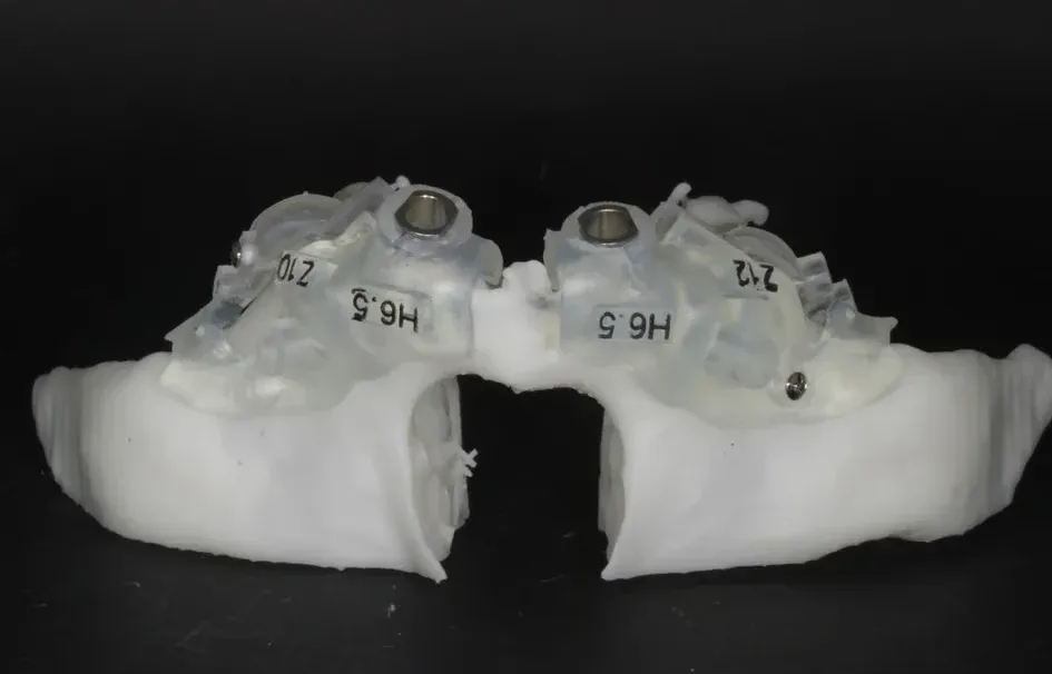 Guia para Implantes Zigomáticos